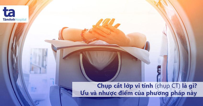 Chạc Là Gì? Hiểu Đúng Về Từ 'Chạc' Trong Đời Sống Và Kỹ Thuật 1 cau truc phan nhanh ky thuat 685b16 1